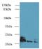 ADP Ribosylation Factor Like GTPase 8B antibody, A58142-100, Epigentek, Western Blot image 