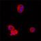 Caspase 2 antibody, MAB7228, R&D Systems, Immunocytochemistry image 