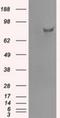 SATB Homeobox 1 antibody, NBP1-47950, Novus Biologicals, Western Blot image 