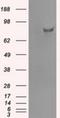 SATB Homeobox 1 antibody, NBP1-47950, Novus Biologicals, Western Blot image 