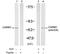 Coactivator Associated Arginine Methyltransferase 1 antibody, GTX78920, GeneTex, Western Blot image 