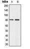 Tumor Protein P73 antibody, MBS820937, MyBioSource, Western Blot image 