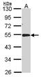 Acid Phosphatase 2, Lysosomal antibody, NBP2-15250, Novus Biologicals, Western Blot image 