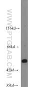 Arrestin Beta 2 antibody, 10171-1-AP, Proteintech Group, Western Blot image 