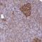 Tripartite Motif Containing 17 antibody, NBP2-49156, Novus Biologicals, Immunohistochemistry paraffin image 