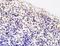 Inositol Polyphosphate-5-Phosphatase A antibody, orb184358, Biorbyt, Immunohistochemistry paraffin image 