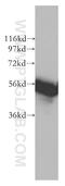 RAD23 Homolog A, Nucleotide Excision Repair Protein antibody, 51033-1-AP, Proteintech Group, Western Blot image 