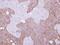 Keratin 15 antibody, GTX100572, GeneTex, Immunohistochemistry paraffin image 