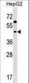 Sialic Acid Binding Ig Like Lectin 9 antibody, LS-C161094, Lifespan Biosciences, Western Blot image 