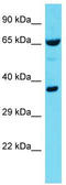 Arginyl Aminopeptidase antibody, TA344801, Origene, Western Blot image 