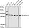 NADH:Ubiquinone Oxidoreductase Core Subunit V2 antibody, 22-942, ProSci, Immunohistochemistry paraffin image 