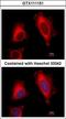 Eukaryotic Translation Elongation Factor 1 Delta antibody, LS-C155318, Lifespan Biosciences, Immunofluorescence image 