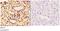 Cyclin G Associated Kinase antibody, A04246-1, Boster Biological Technology, Immunohistochemistry paraffin image 