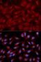 Rap Guanine Nucleotide Exchange Factor 3 antibody, LS-B13963, Lifespan Biosciences, Immunofluorescence image 