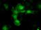 Alcohol dehydrogenase [NADP+] antibody, NBP2-02164, Novus Biologicals, Immunofluorescence image 