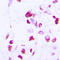 CCAAT Enhancer Binding Protein Delta antibody, LS-C351982, Lifespan Biosciences, Immunohistochemistry frozen image 