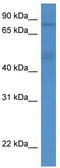 Gamma-adducin antibody, TA342788, Origene, Western Blot image 