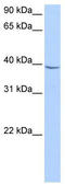 Nudix Hydrolase 17 antibody, TA346683, Origene, Western Blot image 