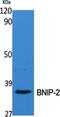 BCL2 Interacting Protein 2 antibody, A07336, Boster Biological Technology, Western Blot image 