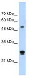 Immunoglobulin Superfamily Member 1 antibody, TA346293, Origene, Western Blot image 