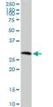 Sarcoglycan Gamma antibody, H00006445-D01P, Novus Biologicals, Western Blot image 