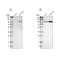 Sad1 And UNC84 Domain Containing 1 antibody, PA5-52564, Invitrogen Antibodies, Western Blot image 