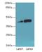 Neuromedin U Receptor 1 antibody, LS-C398055, Lifespan Biosciences, Western Blot image 