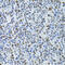Metastasis Associated 1 Family Member 3 antibody, 22-386, ProSci, Immunohistochemistry paraffin image 