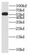 Signal Peptide Peptidase Like 2A antibody, FNab08191, FineTest, Western Blot image 