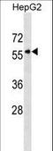 Karyopherin Subunit Alpha 5 antibody, LS-C160017, Lifespan Biosciences, Western Blot image 