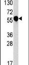 Interleukin 1 Receptor Like 2 antibody, PA5-13368, Invitrogen Antibodies, Western Blot image 