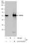 Calcium Binding And Coiled-Coil Domain 2 antibody, GTX115378, GeneTex, Immunoprecipitation image 
