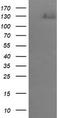ERBB2 antibody, TA505819AM, Origene, Western Blot image 