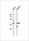 Dehydrogenase/Reductase 3 antibody, GTX80507, GeneTex, Western Blot image 