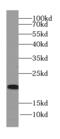 Neurturin antibody, FNab05683, FineTest, Western Blot image 