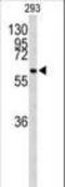 Cell Division Cycle 73 antibody, LS-C168598, Lifespan Biosciences, Western Blot image 