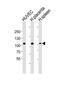 Glycoprotein Ib Platelet Subunit Alpha antibody, MBS9214443, MyBioSource, Western Blot image 