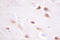 Casein Kinase 2 Beta antibody, LS-C176405, Lifespan Biosciences, Immunohistochemistry frozen image 