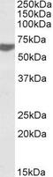 TERF2 Interacting Protein antibody, GTX88131, GeneTex, Western Blot image 