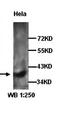 Hyaluronidase 1 antibody, orb77170, Biorbyt, Western Blot image 