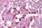 BCL2 Like 14 antibody, MBS241254, MyBioSource, Immunohistochemistry paraffin image 