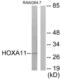 Homeobox A11 antibody, LS-C120042, Lifespan Biosciences, Western Blot image 