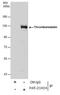 Thrombomodulin antibody, PA5-21924, Invitrogen Antibodies, Immunoprecipitation image 