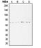 Synaptotagmin 16 antibody, LS-C353587, Lifespan Biosciences, Western Blot image 