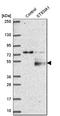 Alpha-N-acetylneuraminide alpha-2,8-sialyltransferase antibody, HPA026775, Atlas Antibodies, Western Blot image 