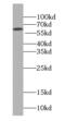Fitzgerald factor antibody, FNab04577, FineTest, Western Blot image 