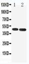 5-Hydroxytryptamine Receptor 1A antibody, PA1647, Boster Biological Technology, Western Blot image 