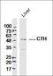 Chloride Voltage-Gated Channel 2 antibody, orb1631, Biorbyt, Western Blot image 