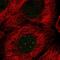 E2F Transcription Factor 5 antibody, HPA055723, Atlas Antibodies, Immunofluorescence image 