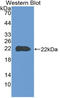 Chloride Intracellular Channel 1 antibody, LS-C314913, Lifespan Biosciences, Western Blot image 
